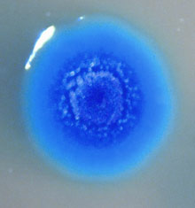 microplasma